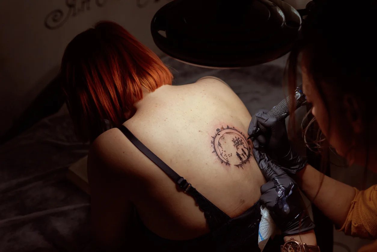 Celly Health technician performing laser tattoo removal